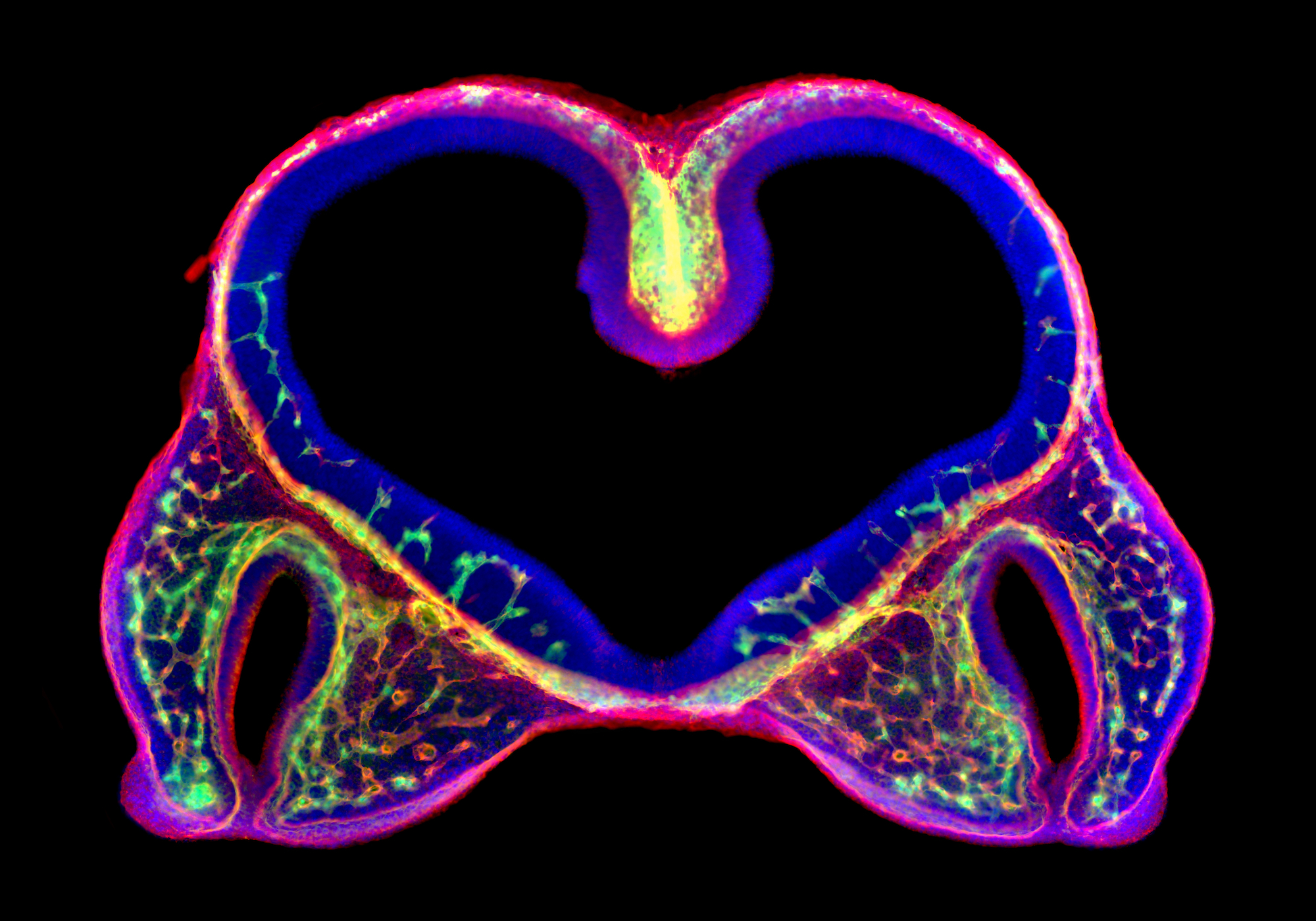 Microscopic image of a section of the head of a mouse embryo, showing blood vessels highlighted in bright fluorescent colors, including one shaped like a heart.