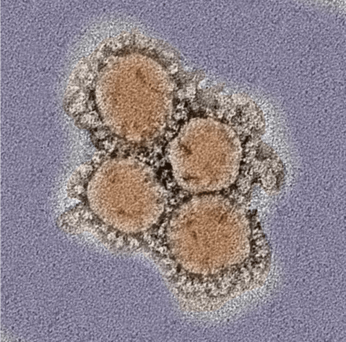 Microscopic image of virus particles