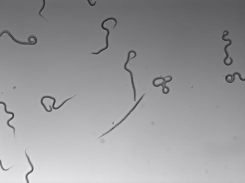Microscopic image of nematodes
