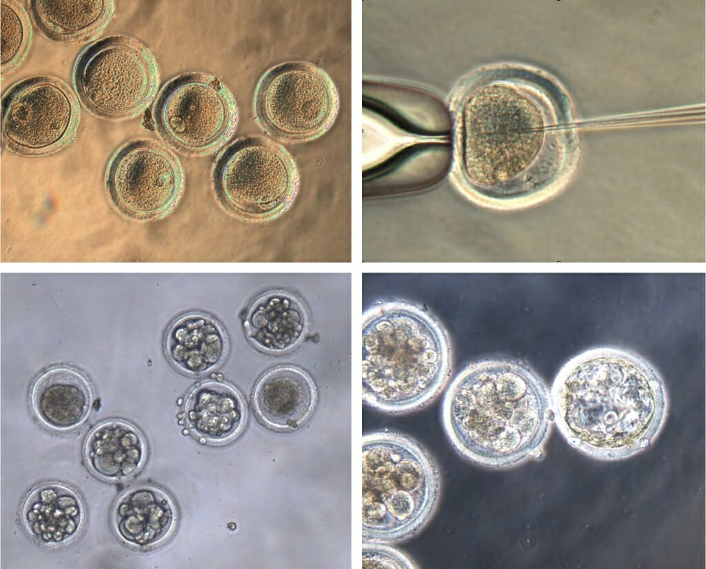 Microscopic images of Egg cells harvested from Mauritian cynomolgus macaques