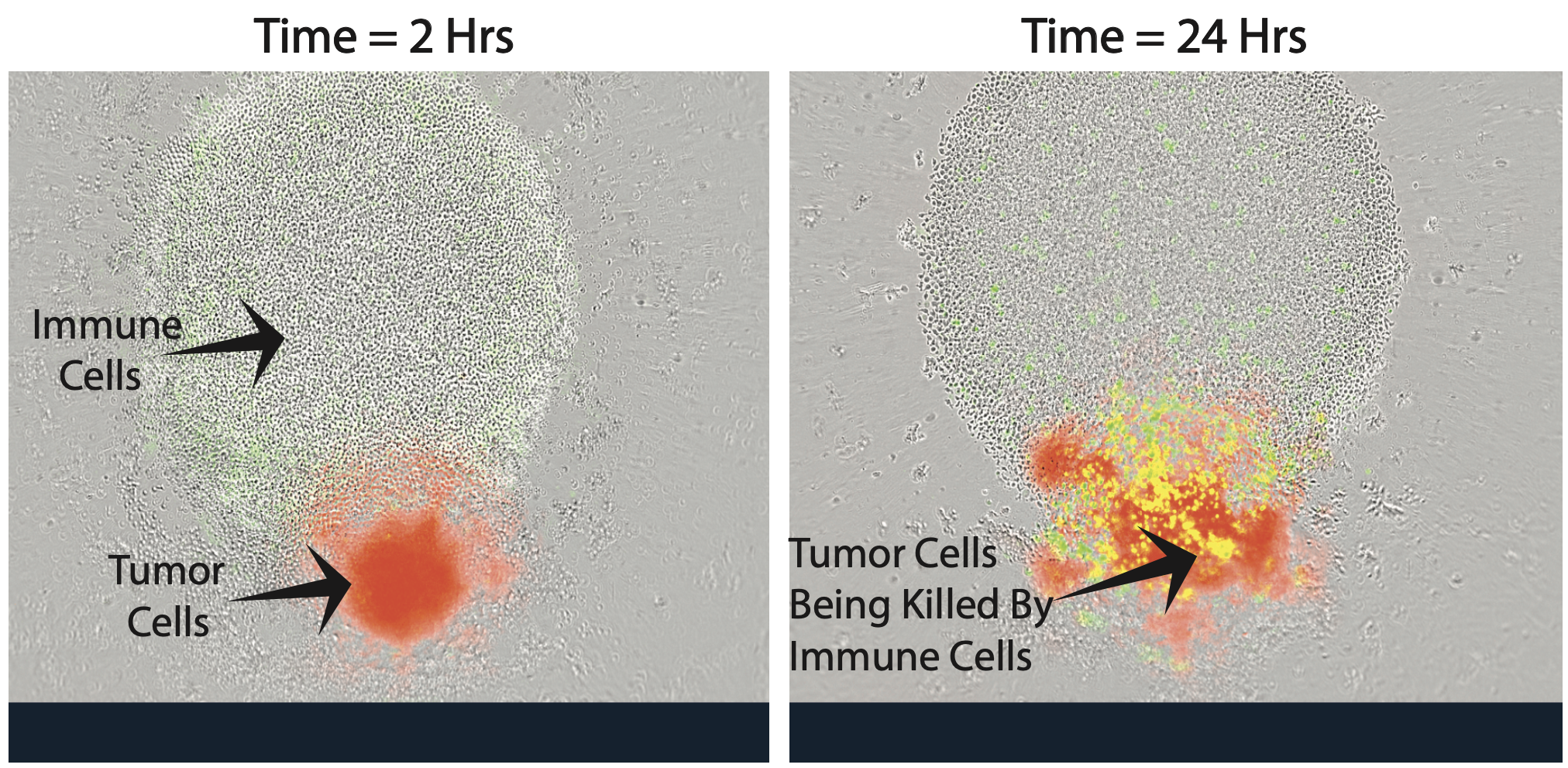 New Method of Killing Cancer Cells Developed