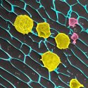 A high-magnification image of the tumor-suppressive gel. The gel is in blue, antibody-bearing platelets are in purple, and modified T-cells are in yellow.