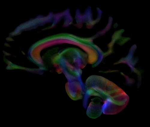 Colorized sections of brain wave image