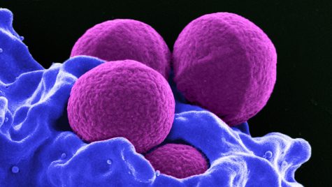 Blue and purple colorized microscopic image of Staphylococcus aureus