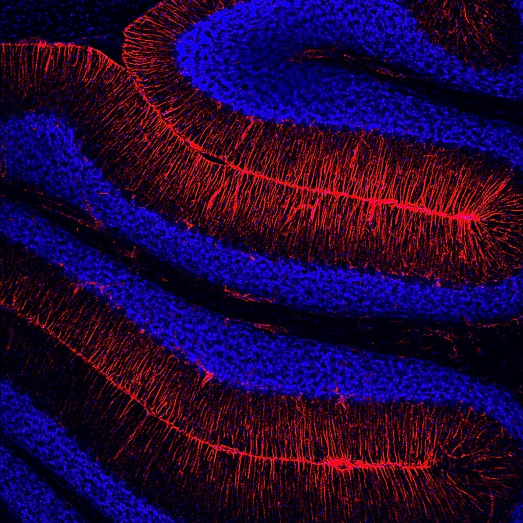This image of brain cells from the cerebellum of a mouse was made possible by the addition of a gene that fuses a fluorescent red molecule to a protein called vimentin, which forms filaments in cell walls and is particularly present during cell development, wound healing and the spread of cancer. The red “tag” allows researchers to tell the blue nuclei from the red vimentin filaments in studies of the mice.
Karolina Lungova,
research intern, Neuroscience;
Darcie Moore,
professor, Neuroscience
confocal microscope
