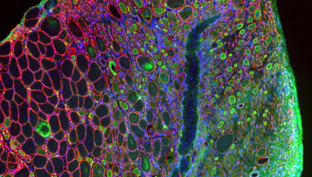 Tissue from a damaged muscle in the leg of a mouse includes healthy, uninjured cells appearing empty and outlined in red. Researchers studying the way aging and disease disrupt muscle growth and regeneration are interested in the difference between those healthy cells and the green-and-blue muscle stem cells, called satellite cells, which are missing a protein necessary for the healing process.
Jamie Hibbert,
postdoctoral fellow, Comparative Biosciences
Keyence microscope