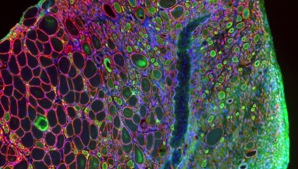 Tissue from a damaged muscle in the leg of a mouse includes healthy, uninjured cells appearing empty and outlined in red. Researchers studying the way aging and disease disrupt muscle growth and regeneration are interested in the difference between those healthy cells and the green-and-blue muscle stem cells, called satellite cells, which are missing a protein necessary for the healing process.
Jamie Hibbert,
postdoctoral fellow, Comparative Biosciences
Keyence microscope