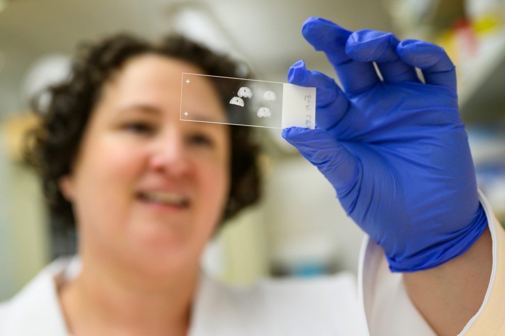 Kirstan Gimse holds up a microscope slide containing thin slices of sample tissue.