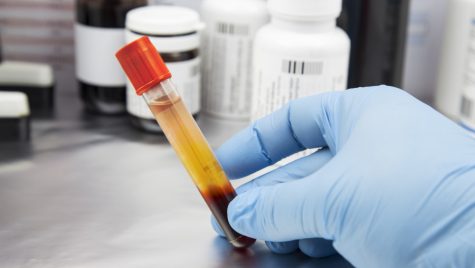 A gloved hand holds a sample vile containing blood plasma.
