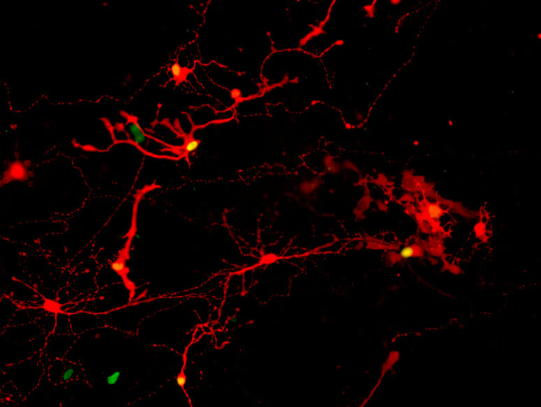 synapses