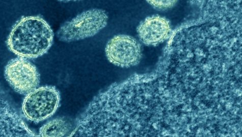 A group of about a dozen roughly circular virus particles swarm around the edge of a much larger cell that is only partially in view.