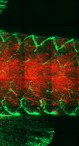 Viewed under microscope, the base of an adult zebrafish's fin shows T cells in bright green moving along the outer edges of the fish's scales while fish's lymphoid network and blood vessels appear red. Because the fish is transparent, the insides of the scales and background are black.