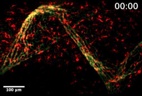 Live video microscopy highlights the flow of T cells in a colorful, undulating stream of red, green and yellow flow of the tessellated lymphoid network in a zebrafish.