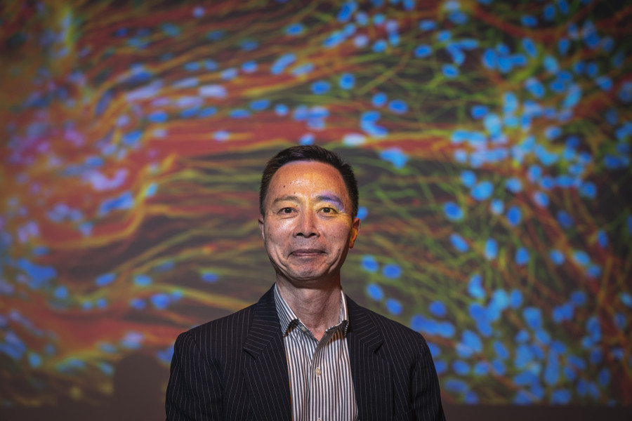 UWMadison researchers first to 3Dprint functional human brain tissue