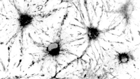 A black-and-white image of neurons connected in a network of hubs and spindly spokes.