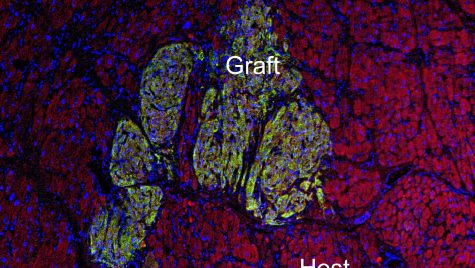 MayoHeartGraft_PressRelease_JMM102224