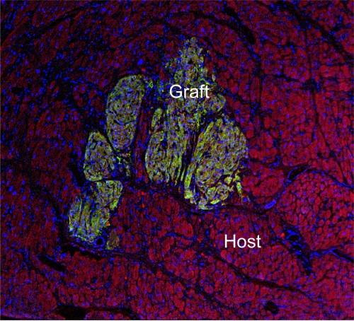 Human stem cell-derived heart cells are safe in monkeys, could treat congenital heart disease