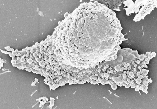 A black and white photo of a bubbly substance.