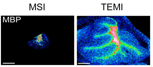 Two images of the same molecule juxtapose the difference between the old and new imaging techniques.