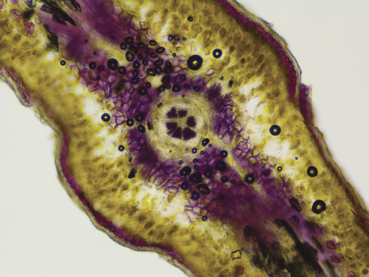 Under a microscope, the lignen cells of a leaf are stained purple against an amber background.