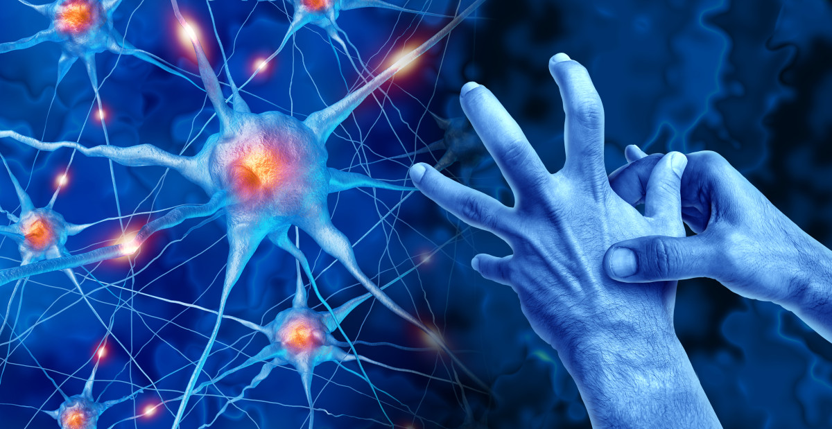 Illustration of nerve cells and hands in pain