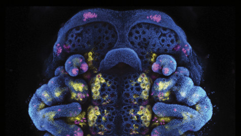 Photo of a a squat, teddy-bear-like bark scorpion embryo colored in dark blue with bright pink and yellow speckles.
