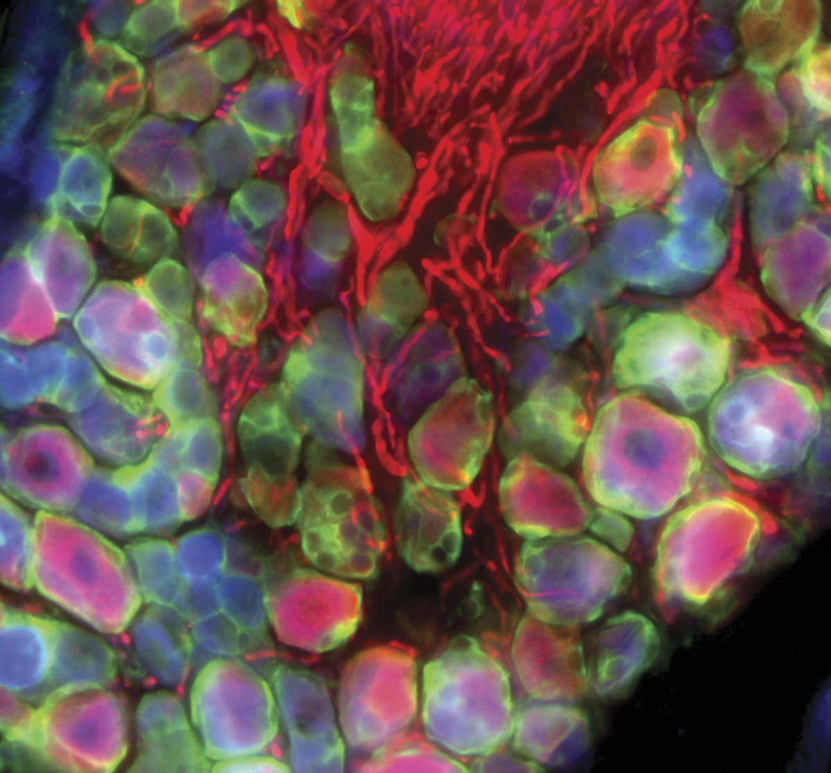 Under a microscope, mouse nerve cells lit up in red t, thread through a cobblestone pattern of brain cells colored in bright pinks, purples, greens and blues.
