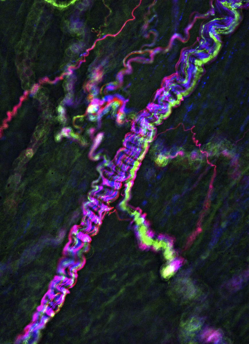 A shock of iridescent squiggles extend across a black background. They're nerve cells under a fluorescent microscope.