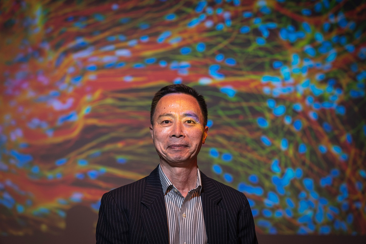 A portrait of a person with a projection of brain tissue behind them