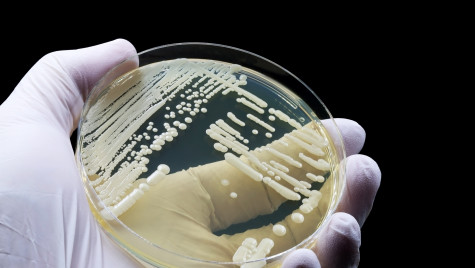 Hand wearing a medical glove shows a microbiological culture of the yeast Candida auris.
