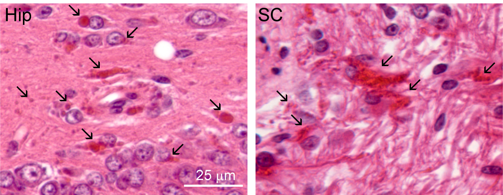 Microscopic images of brain samples.